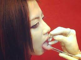 Thú chơi xỏ khuyên lưỡi gây hỏng phát âm, biến đổi giọng nói